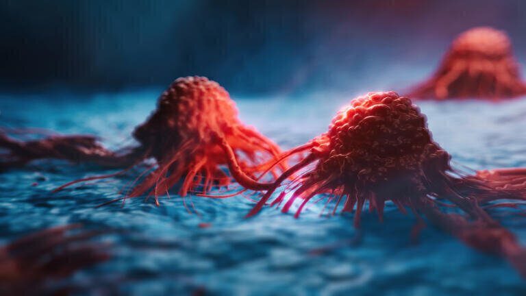 Ovarian cancer cells. Credit: The Wistar Institute