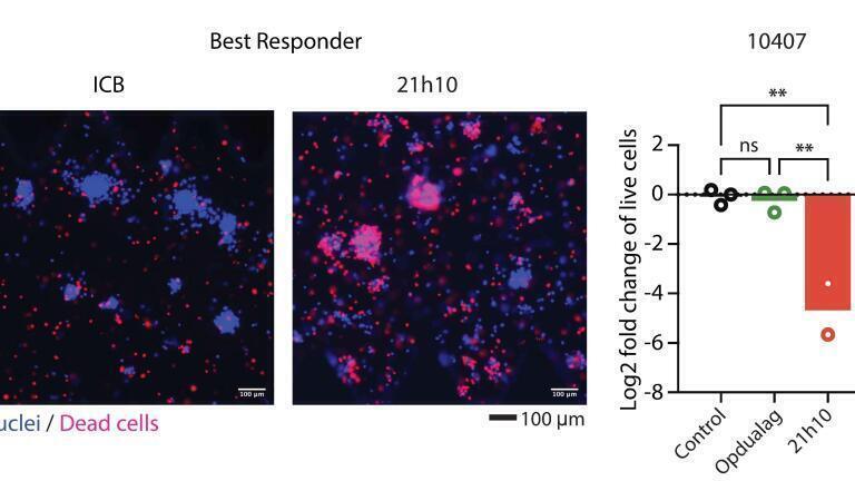 Representative images and viability assessment of the best responder PDOTS to 21h10 [patient 10407 in (F)]. Significance was determined using one-way ANOVA with Tukey’s correction. PI-dead cells in red and Hoechst-nuclei in blue. IP, intraperitoneal. Credit: Jung-Ho Chun