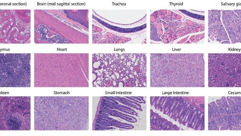 Toxicity profiling of 21h10 treatment. Immunohistochemistry (IHC) staining of tissues other than pancreas from 21h10-treated WT mice. Data are representative of two experiments. Credit: Jung-Ho Chun