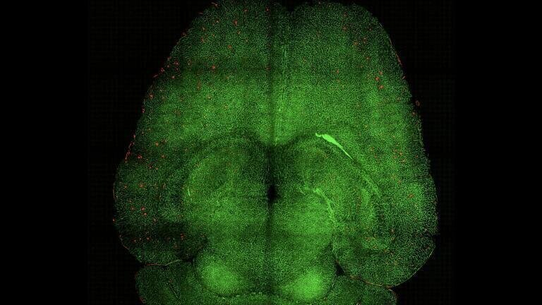 Light sheet fluorescence microscope image of mouse brain 12h after being treated with nanoparticles. The brains were analysed to see the amount of Aβ plaques accumulation. Red: Aβ plaques. Green: vessels from the blood brain barrier. Credit: Institute for Bioengineering of Catalonia