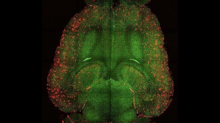 Light sheet fluorescence microscope images of mouse brain 12h after NOT being treated with nanoparticles. The brains were analysed to see the amount of Aβ plaques accumulation. Red: Aβ plaques. Green: vessels from the blood brain barrier. Credit: Institute for Bioengineering of Catalonia