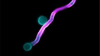 UK scientists lead global effort to combat antifungal resistance