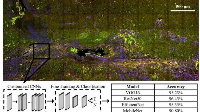 Label-free multiphoton microscopy and deep learning can be used in combination to classify pancreatic neuroendocrine neoplasms with high accuracy – a significant step toward automated digital pathology for such tumours. Credit: N. Daigle (University of Arizona)