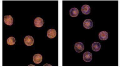 Microscopy uncovers ‘hidden record’ of blood sugar history