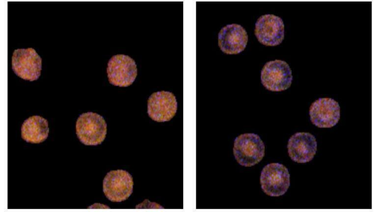 Microscopy uncovers ‘hidden record’ of blood sugar history
