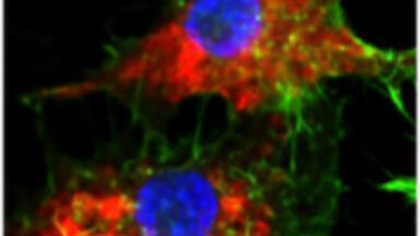 Chemotherapy drug transformed by SNA nanotherapy into powerful targeted cancer treatment