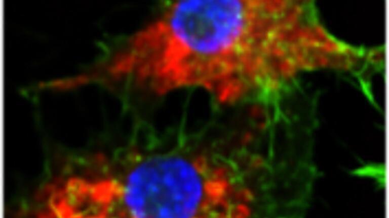Chemotherapy drug transformed by SNA nanotherapy into powerful targeted cancer treatment