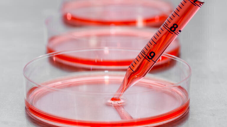 Detached cells in cell culture.