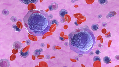 New therapy shows promise in challenging blood cancers