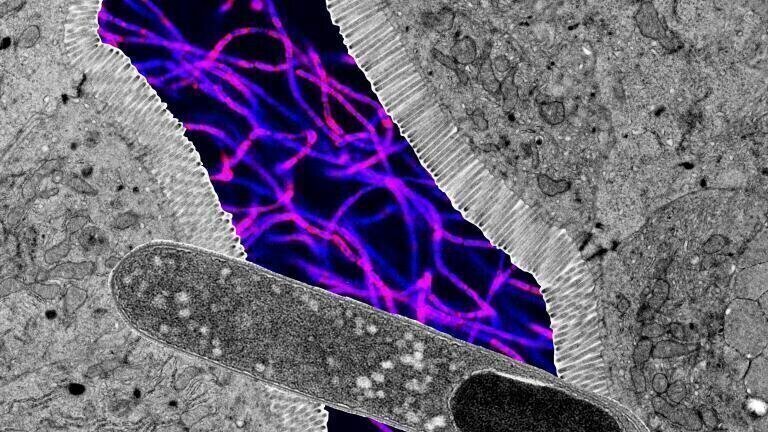 Collage of microscope images showing a rod-shaped Turicibacter (foreground), cross section of intestine, and fluorescent microscopy of more bacteria (background). Images not to scale. Credit: Kendra Klag