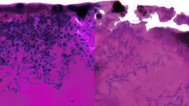 Genetic vulnerability in deadly Candida auris offers potential drug target