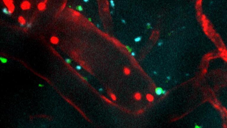 Immune cells (shown in red) injected into an area injured by ischemic stroke. The peptide treatment (blue) successfully crosses the blood-brain barrier (red). Microglia (green) become active and surround the treatment, which indicates an elevated immune response. Recorded over five minutes and sped up here 60x. Credit: Northwestern University