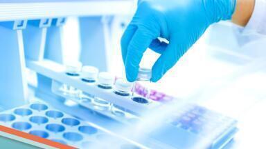 New buyer’s guide helps teams choose the right approach to nitrosamine testing