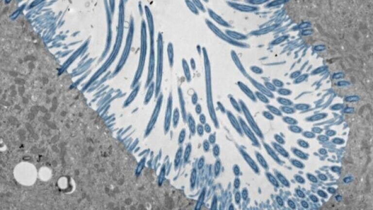 Electron micrograph of differentiated human nasal epithelial organoids with cilia of multiciliate cells accentuated in blue. Credit: Julien Amat & Bao Wang