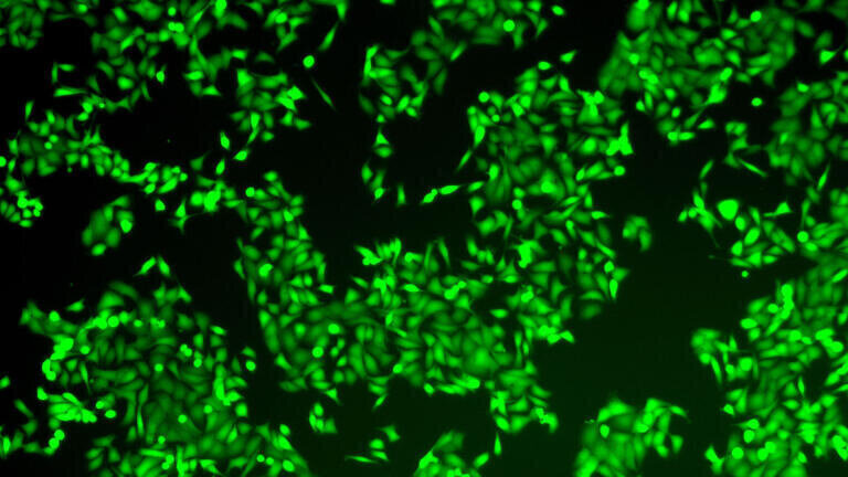 The Krainer lab developed 12 initial ASO drug candidates. The best performing ASO—ASO-A—completely broke the SRSF1-AURKA-MYC circuit, leading to slower tumour growth and cell death. Left: Untreated PDAC tumour organoid. Right: PDAC tumour organoid after treatment with ASO-A. Credit: Krainer lab/CSHL
