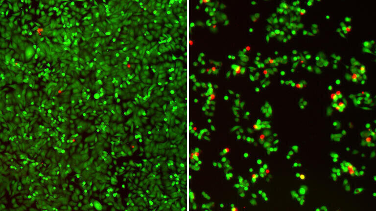 CSHL’s Krainer lab has discovered a key oncogenic circuit driving aggressive pancreatic ductal adenocarcinoma (PDAC) progression. Using human PDAC tumour organoids, seen here, the team developed a potential RNA splicing-based therapeutic that collapses the circuit. Credit: Krainer lab/CSHL