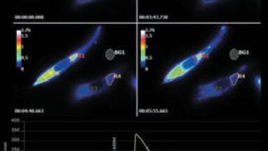 Capturing Fast Intracellular Processes