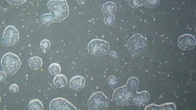 Pre-culture conditions guide cardiac differentiation in iPS cells