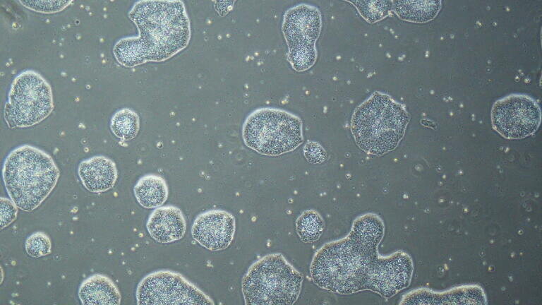 Pre-culture conditions guide cardiac differentiation in iPS cells