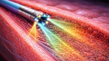 Miniature fibre probe extends optical coherence tomography imaging depth and quality