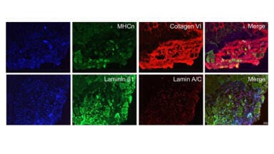 Efficient differentiation kit generates high-purity myogenic cells
