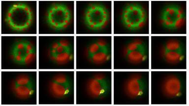 Tuberculosis bacteria stiffen immune cell membranes to evade destruction: study