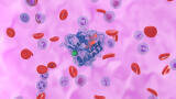 New combination therapy tackles resistant KRAS lung cancer