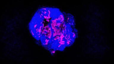 Study uses cytomegalovirus immunity to slow pancreatic tumour growth in mice