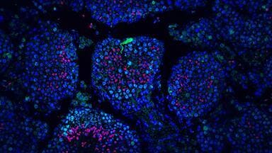 Targeted messenger RNA restores fertility in genetically infertile male mouse model
