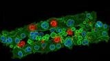 £4.5 million initiative targets deadly fungal pathogens