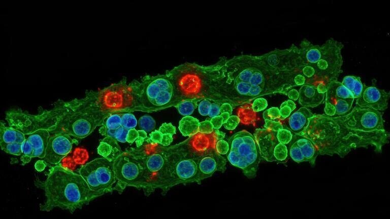 £4.5 million initiative targets deadly fungal pathogens