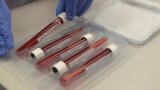 Safer sample transport, simplified