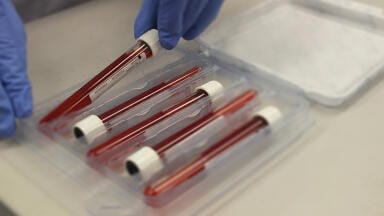 Safer sample transport, simplified