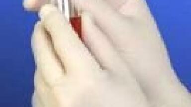 New Chemo Glove for Latex Free Areas
