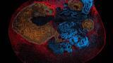 Light sheet microscopy maps drug behaviour in 3D models