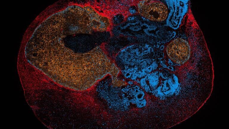 Light sheet microscopy maps drug behaviour in 3D models