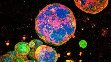 Fully defined 3D matrix supports colorectal cancer organoid growth