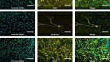 New iPSC kits deliver rapid neural cell differentiation