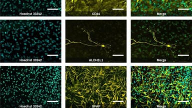 New iPSC kits deliver rapid neural cell differentiation