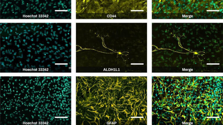 New iPSC kits deliver rapid neural cell differentiation