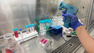 Pipette controller accelerates skin fibrosis biomarker research