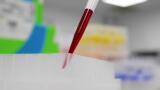 The one step your diagnostic sample prep might be missing