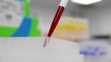 The one step your diagnostic sample prep might be missing