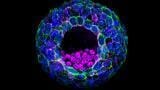 Stem cell embryo models shed light on early human development