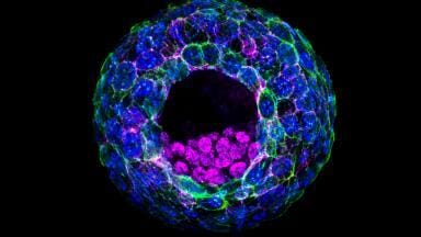Stem cell embryo models shed light on early human development