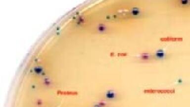 New Chromogenic Uti Medium is Launched: New Clarity Agar Improves Differentiation of Uti Pathogens