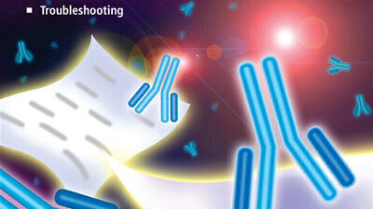 Brand new Western blotting handbook. Request your complimentary copy today.