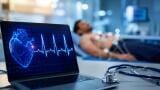 Artificial intelligence model predicts risk of future stroke from 10-second ECG test