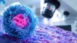FOXA1 protein could be a diagnostic marker for aggressive prostate cancer