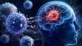 Novel CAR T cell therapy shows strong early promise to 'eliminate' glioblastoma